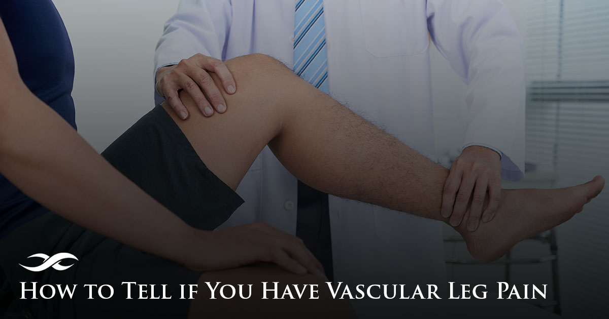 How to Tell if You Have Vascular Leg Pain - Vascular and Vein Institute of  Siouxland